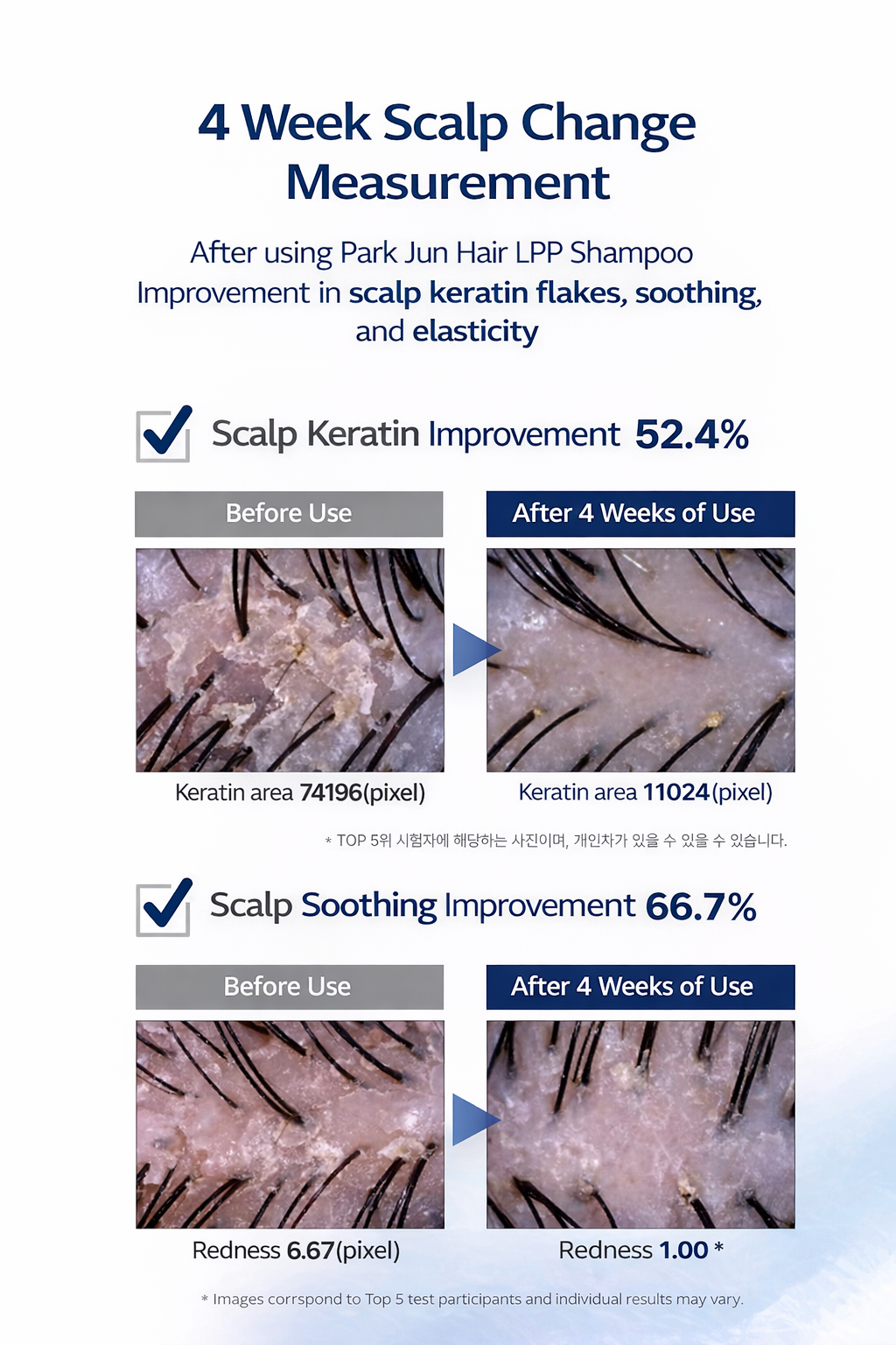 LPP Salon Volume Hair Loss Care Shampoo